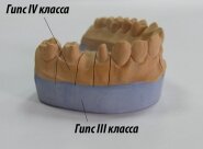Зуботехнический гипс Гипс Gilrock VI класс